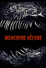 Железное лёгкое